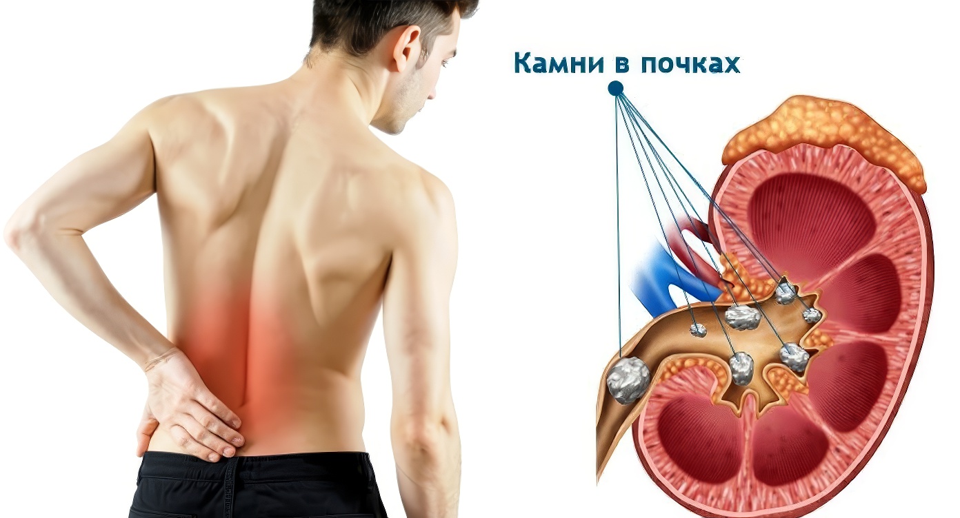 Натуральная минеральная вода