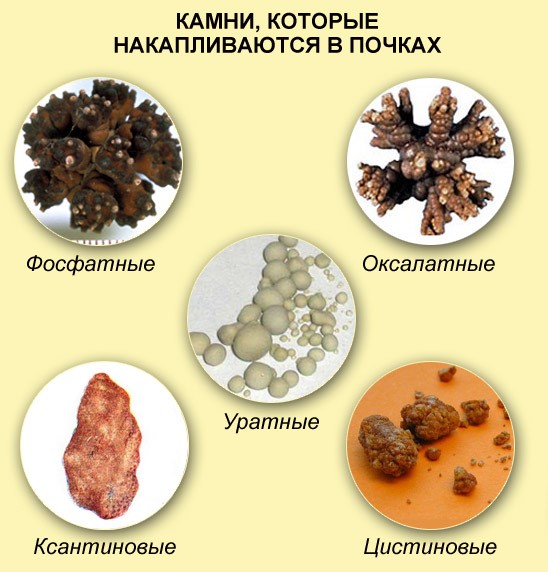 Врач-уролог и пациент